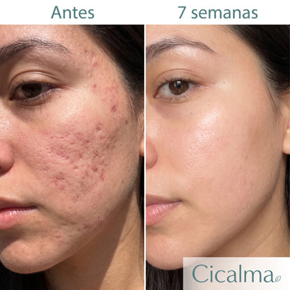 Scar Stick Cicalma — Barra Reparadora de Cicatrices